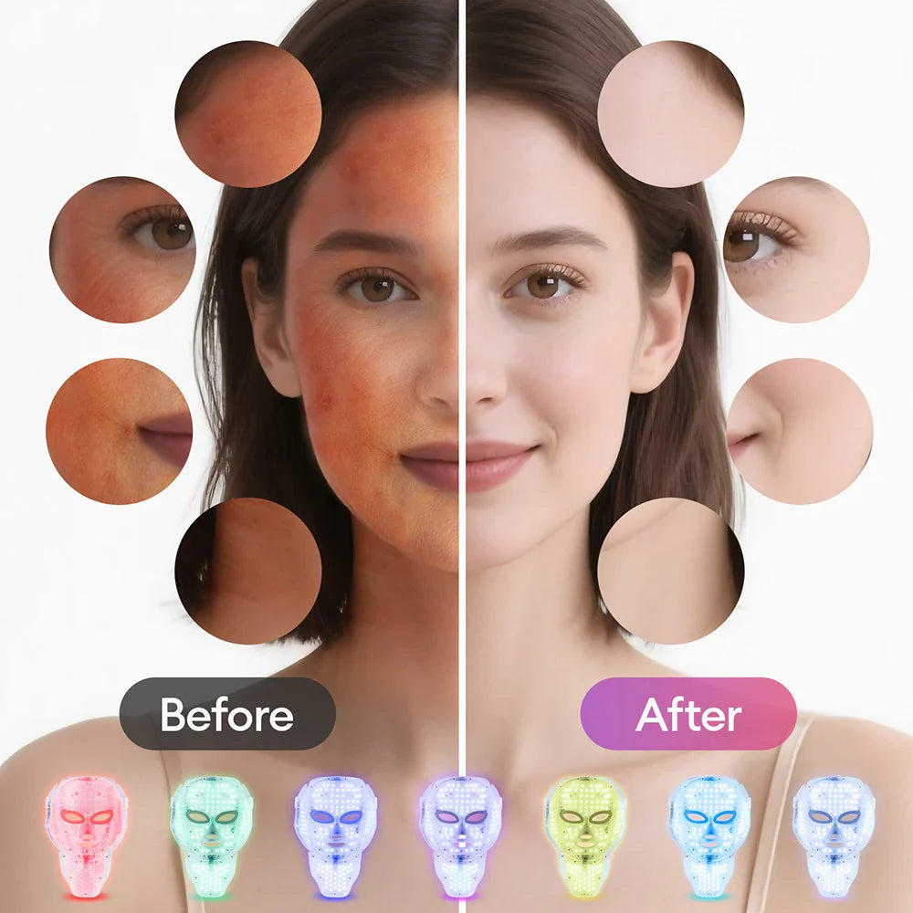 Glow & Renew LED Beauty Mask